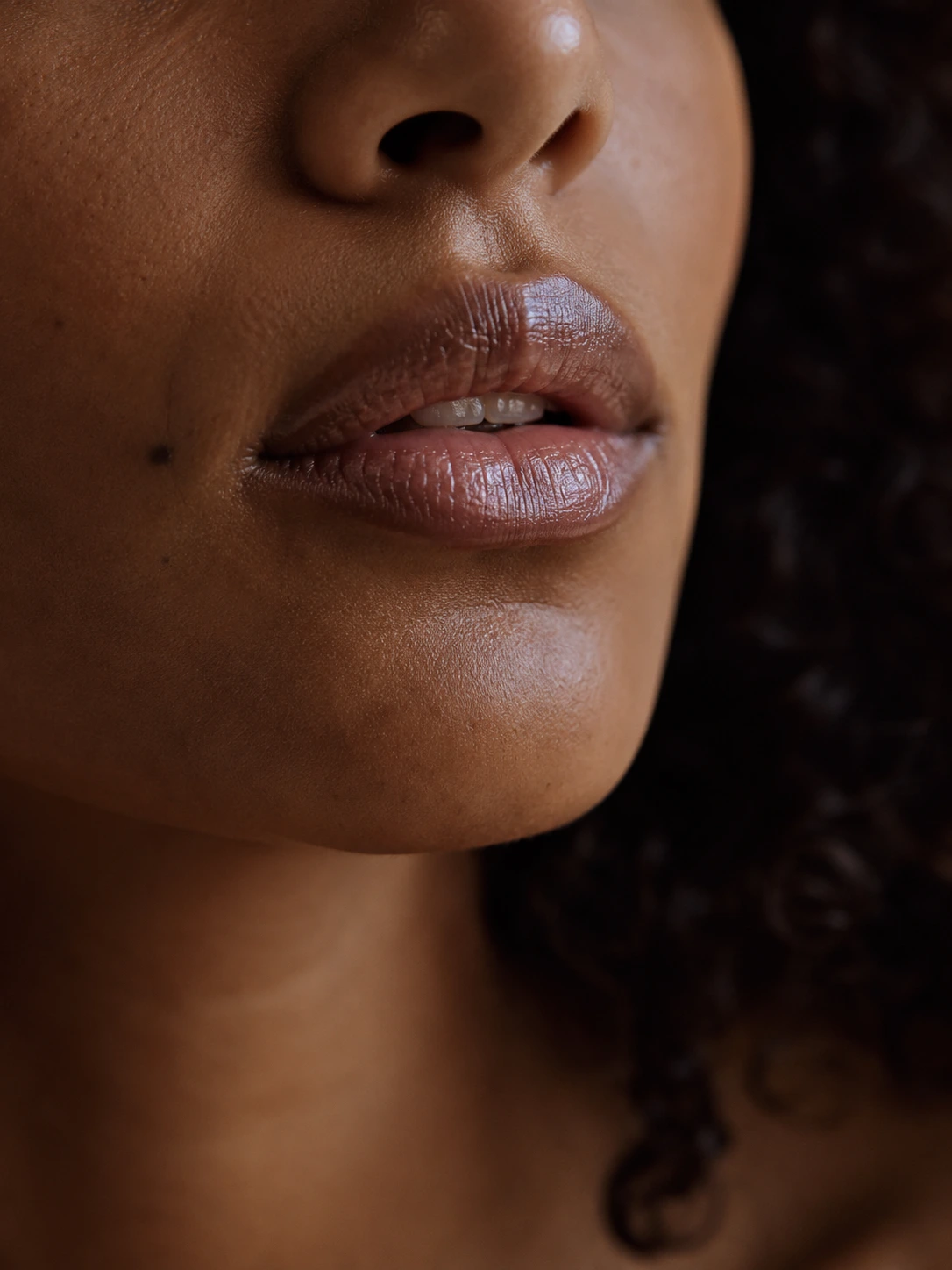 Preenchimento labial em Ponta Grossa